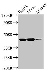 Western Blot
Positive WB detected in: Rat heart tissue, Rat liver tissue, Rat kidney tissue
All lanes: IL10RB antibody at 2ug/ml
Secondary
Goat polyclonal to rabbit IgG at 1/50000 dilution
Predicted band size: 37 kDa
Observed band size: 45 kDa