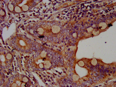 IHC image of CSB-PA600257LA01HU diluted at 1:500 and staining in paraffin-embedded human small intestine tissue performed on a Leica BondTM system. After dewaxing and hydration, antigen retrieval was mediated by high pressure in a citrate buffer (pH 6.0). Section was blocked with 10% normal goat serum 30min at RT. Then primary antibody (1% BSA) was incubated at 4&deg;C overnight. The primary is detected by a biotinylated secondary antibody and visualized using an HRP conjugated SP system.