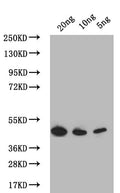 Western Blot
Positive WB detected in: recombinant protein
All lanes: PDLP7 Antibody at 1:1000
Secondary
Goat polyclonal to rabbit IgG at 1/50000 dilution
Predicted band size: 43.7 kDa
Observed band size: 43.7 kDa