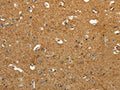The image on the left is immunohistochemistry of paraffin-embedded Human brain tissue using CSB-PA610964(AKAP12 Antibody) at dilution 1/40, on the right is treated with synthetic peptide. (Original magnification: ×200)