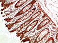 ATM Antibody – Figure 1 of 3