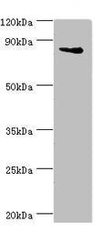 ILF3 Antibody – Figure 1 of 3