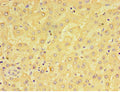 Immunohistochemistry of paraffin-embedded human liver tissue using CSB-PA613493ESR2HU at dilution of 1:100