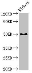 Western Blot
Positive WB detected in: Mouse kidney tissue
All lanes: PDK1 antibody at 2.8ug/ml
Secondary
Goat polyclonal to rabbit IgG at 1/50000 dilution
Predicted band size: 50, 52 kDa
Observed band size: 50 kDa