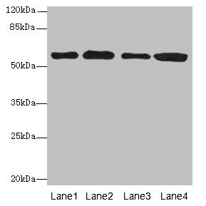 Western blot All lanes: TXNRD1 antibody at 5µg/ml Lane 1: Jurkat whole cell lysate Lane 2: A549 whole cell lysate Lane 3: MCF-7 whole cell lysate Lane 4: Hela whole cell lysate Secondary Goat polyclonal to rabbit IgG at 1/10000 dilution Predicted band size: 71, 60, 66, 61, 55, 68, 51 kDa Observed band size: 60 kDa