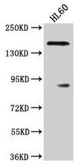 Western Blot
Positive WB detected in: HL60 whole cell lysate
All lanes: ROCK1 antibody at 1:2000
Secondary
Goat polyclonal to rabbit IgG at 1/50000 dilution
Predicted band size: 159 kDa
Observed band size: 159 kDa