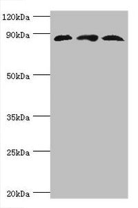 Western blot
All lanes: Cullin-1 antibody at 6ug/ml
Lane 1: PC-3 whole cell lysate
Lane 2: K562 whole cell lysate
Lane 3: Hela whole cell lysate
Secondary
Goat polyclonal to rabbit IgG at 1/10000 dilution
Predicted band size: 90 kDa
Observed band size: 90 kDa