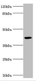 Western blot
All lanes: Alkylated DNA repair protein alkB homolog 1 antibody at 9ug/ml + Mouse kidney tissue
Secondary
Goat polyclonal to rabbit IgG at 1/10000 dilution
Predicted band size: 44 kDa
Observed band size: 44 kDa