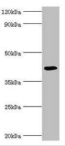 Western blot
All lanes: Alkylated DNA repair protein alkB homolog 1 antibody at 9ug/ml + Mouse kidney tissue
Secondary
Goat polyclonal to rabbit IgG at 1/10000 dilution
Predicted band size: 44 kDa
Observed band size: 44 kDa