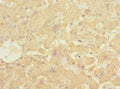 Immunohistochemistry of paraffin-embedded human liver tissue using CSB-PA614444ESR1HU at dilution of 1:100
