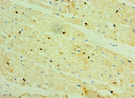 Immunohistochemistry of paraffin-embedded human heart tissue using CSB-PA614956ESR1HU at dilution of 1:100