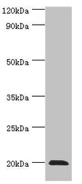Western blot
All lanes: Heat shock protein beta-2 antibody at 3ug/ml + Mouse skeletal muscle tissue
Secondary
Goat polyclonal to rabbit IgG at 1/10000 dilution
Predicted band size: 20 kDa
Observed band size: 20 kDa