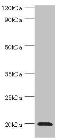 Western blot
All lanes: Heat shock protein beta-2 antibody at 3ug/ml + Mouse skeletal muscle tissue
Secondary
Goat polyclonal to rabbit IgG at 1/10000 dilution
Predicted band size: 20 kDa
Observed band size: 20 kDa