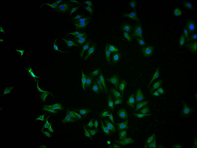 Immunofluorescence staining of HepG2 cells with CSB-PA614961LA01HU at 1:100, counter-stained with DAPI. The cells were fixed in 4% formaldehyde and blocked in 10% normal Goat Serum. The cells were then incubated with the antibody overnight at 4°C. The secondary antibody was Alexa Fluor 488-congugated AffiniPure Goat Anti-Rabbit IgG(H+L).