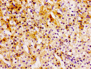 Immunohistochemistry of paraffin-embedded human adrenal gland tissue using CSB-PA614984LA01HU at dilution of 1:100