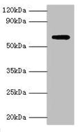 Western blot
All lanes: Anti-Muellerian hormone type-2 receptor antibody at 15ug/ml + Mouse brain tissue
Secondary
Goat polyclonal to rabbit IgG at 1/10000 dilution
Predicted band size: 63, 53, 52 kDa
Observed band size: 63 kDa