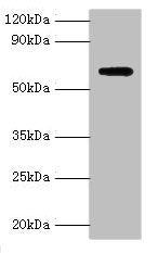Western blot
All lanes: Anti-Muellerian hormone type-2 receptor antibody at 15ug/ml + Mouse brain tissue
Secondary
Goat polyclonal to rabbit IgG at 1/10000 dilution
Predicted band size: 63, 53, 52 kDa
Observed band size: 63 kDa