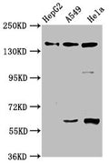 Western BlotPositive WB detected in: HepG2 whole cell lysate, A549 whole cell lysate, Hela whole cell lysateAll lanes: NAIP antibody at 3.3µg/mlSecondaryGoat polyclonal to rabbit IgG at 1/50000 dilutionPredicted band size: 160, 142 kDaObserved band size: 160 kDa