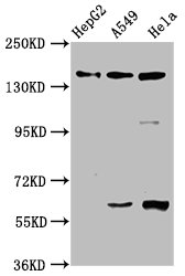 Western BlotPositive WB detected in: HepG2 whole cell lysate, A549 whole cell lysate, Hela whole cell lysateAll lanes: NAIP antibody at 3.3µg/mlSecondaryGoat polyclonal to rabbit IgG at 1/50000 dilutionPredicted band size: 160, 142 kDaObserved band size: 160 kDa