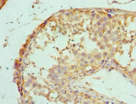 Immunohistochemistry of paraffin-embedded human testis tissue using CSB-PA615667ESR1HU at dilution of 1:100