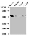 Western Blot
Positive WB detected in: HepG2 whole cell lysate, HEK293 whole cell lysate, Rat liver tissue, Mouse liver tissue
All lanes: MAP2K5 antibody at 3.5µg/ml
Secondary
Goat polyclonal to rabbit IgG at 1/50000 dilution
Predicted band size: 51, 49, 50, 47 kDa
Observed band size: 51 kDa