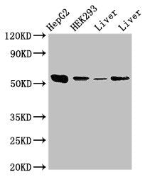 Western Blot
Positive WB detected in: HepG2 whole cell lysate, HEK293 whole cell lysate, Rat liver tissue, Mouse liver tissue
All lanes: MAP2K5 antibody at 3.5µg/ml
Secondary
Goat polyclonal to rabbit IgG at 1/50000 dilution
Predicted band size: 51, 49, 50, 47 kDa
Observed band size: 51 kDa