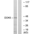 Western blot analysis of extracts from COLO cells, using DOK6 antibody.