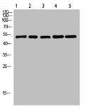 Western Blot analysis of 1,mouse-lung 2,mouse-brain 3,mouse-spleen 4,mouse-kidney 5,mouse-heart cells using primary antibody diluted at 1:500(4°C overnight). Secondary antibody:Goat Anti-rabbit IgG IRDye 800( diluted at 1:5000, 25°C, 1 hour)