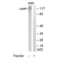 Western blot analysis of extracts from K562, Jurkat, HepG2, HuvEc, HeLa and COLO205 cells, using LAMP1 antibody.