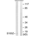 Western blot analysis of extracts from COLO cells, using S100Z antibody.