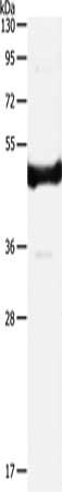 Gel: 8%SDS-PAGE, Lysate: 40 ug, Lane: 293T cells, Primary antibody: CSB-PA617473(IL11RA Antibody) at dilution 1/350, Secondary antibody: Goat anti rabbit IgG at 1/8000 dilution, Exposure time: 1 minute