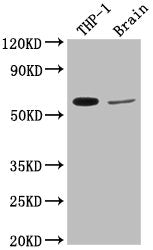 Western Blot
Positive WB detected in: THP-1 whole cell lysate, Rat brain tissue
All lanes: COL9A2 antibody at 1:2000
Secondary
Goat polyclonal to rabbit IgG at 1/50000 dilution
Predicted band size: 66 kDa
Observed band size: 66 kDa
