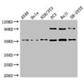 Western Blot
Positive WB detected in: A549 whole cell lysate, Hela whole cell lysate, NIH/3T3 whole cell lysate, PC-3 whole cell lysate, Raji whole cell lysate, SH-SY5Y whole cell lysate
All lanes: BECN1 antibody at 4µg/ml
Secondary
Goat polyclonal to rabbit IgG at 1/50000 dilution
Predicted band size: 52 kDa
Observed band size: 52 kDa