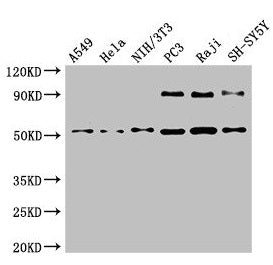 Western Blot
Positive WB detected in: A549 whole cell lysate, Hela whole cell lysate, NIH/3T3 whole cell lysate, PC-3 whole cell lysate, Raji whole cell lysate, SH-SY5Y whole cell lysate
All lanes: BECN1 antibody at 4µg/ml
Secondary
Goat polyclonal to rabbit IgG at 1/50000 dilution
Predicted band size: 52 kDa
Observed band size: 52 kDa