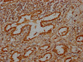 IHC image of CSB-PA617930LA01HU diluted at 1:100 and staining in paraffin-embedded human lung tissue performed on a Leica BondTM system. After dewaxing and hydration, antigen retrieval was mediated by high pressure in a citrate buffer (pH 6.0). Section was blocked with 10% normal goat serum 30min at RT. Then primary antibody (1% BSA) was incubated at 4°C overnight. The primary is detected by a Goat anti-rabbit IgG labeled by HRP and visualized using 0.05% DAB.
