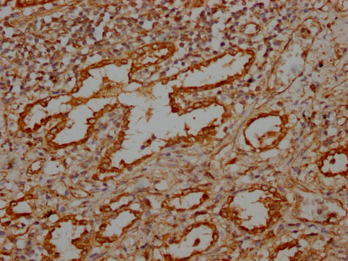IHC image of CSB-PA617930LA01HU diluted at 1:100 and staining in paraffin-embedded human lung tissue performed on a Leica BondTM system. After dewaxing and hydration, antigen retrieval was mediated by high pressure in a citrate buffer (pH 6.0). Section was blocked with 10% normal goat serum 30min at RT. Then primary antibody (1% BSA) was incubated at 4°C overnight. The primary is detected by a Goat anti-rabbit IgG labeled by HRP and visualized using 0.05% DAB.