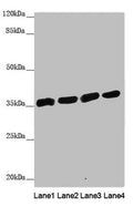 Western blot All lanes: ANKRD1 antibody at 1.91µg/ml Lane 1: Hela whole cell lysate Lane 2: 293T whole cell lysate Lane 3: Jurkat whole cell lysate Lane 4: HepG2 whole cell lysate Secondary Goat polyclonal to rabbit IgG at 1/10000 dilution Predicted band size: 36 kDa Observed band size: 36 kDa