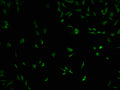 Immunofluorescence staining of SH-SY5Y cells with CSB-PA618015LA01HU at 1:100, counter-stained with DAPI. The cells were fixed in 4% formaldehyde and blocked in 10% normal Goat Serum. The cells were then incubated with the antibody overnight at 4°C. The secondary antibody was Alexa Fluor 488-congugated AffiniPure Goat Anti-Rabbit IgG(H+L).