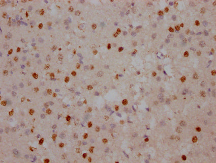 IHC image of CSB-PA618018DA01HU diluted at 1:100 and staining in paraffin-embedded human brain tissue performed on a Leica BondTM system. After dewaxing and hydration, antigen retrieval was mediated by high pressure in a citrate buffer (pH 6.0). Section was blocked with 10% normal goat serum 30min at RT. Then primary antibody (1% BSA) was incubated at 4°C overnight. The primary is detected by a Goat anti-rabbit IgG labeled by HRP and visualized using 0.05% DAB.