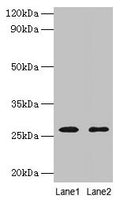 Western blot All lanes: ADIPOQ antibody at 2µg/ml Lane 1: NIH/3T3 whole cell lysate Lane 2: HL60 whole cell lysate Secondary Goat polyclonal to rabbit IgG at 1/10000 dilution Predicted band size: 27 kDa Observed band size: 27 kDa