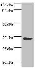 Western blot
All lanes: Aminoacyl tRNA synthase complex-interacting multifunctional protein 1 antibody at 2ug/ml + HepG2 whole cell lysate
Secondary
Goat polyclonal to rabbit IgG at 1/10000 dilution
Predicted band size: 35, 38 kDa
Observed band size: 35 kDa
