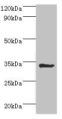 Western blot
All lanes: Aminoacyl tRNA synthase complex-interacting multifunctional protein 1 antibody at 2ug/ml + HepG2 whole cell lysate
Secondary
Goat polyclonal to rabbit IgG at 1/10000 dilution
Predicted band size: 35, 38 kDa
Observed band size: 35 kDa