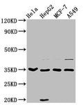 Western Blot
Positive WB detected in: Hela whole cell lysate, HepG2 whole cell lysate, MCF-7 whole cell lysate, A549 whole cell lysate
All lanes: AIMP1 antibody at 3.7µg/ml
Secondary
Goat polyclonal to rabbit IgG at 1/50000 dilution
Predicted band size: 35, 38 kDa
Observed band size: 35 kDa