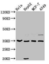 Western Blot
Positive WB detected in: Hela whole cell lysate, HepG2 whole cell lysate, MCF-7 whole cell lysate, A549 whole cell lysate
All lanes: AIMP1 antibody at 3.7µg/ml
Secondary
Goat polyclonal to rabbit IgG at 1/50000 dilution
Predicted band size: 35, 38 kDa
Observed band size: 35 kDa