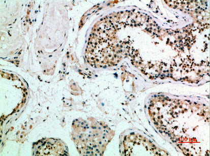 FZD9 Antibody – Figure 1 of 4