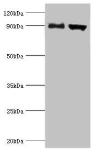 Western blot
All lanes: Disintegrin and metalloproteinase domain-containing protein 9 antibody at 2ug/ml
Lane 1: Mouse liver tissue
Lane 2: Mouse heart tissue
Secondary
Goat polyclonal to rabbit IgG at 1/10000 dilution
Predicted band size: 91, 73 kDa
Observed band size: 91 kDa