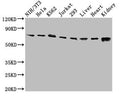 Western Blot
Positive WB detected in: NIH/3T3 whole cell lysate, Hela whole cell lysate, K562 whole cell lysate, Jurkat whole cell lysate, 293 whole cell lysate, Rat liver tissue, Mouse heart tissue, Mouse kidney tissue
All lanes: RIPK1 antibody at 3.2µg/ml
Secondary
Goat polyclonal to rabbit IgG at 1/50000 dilution
Predicted band size: 76, 71 kDa
Observed band size: 76 kDa
