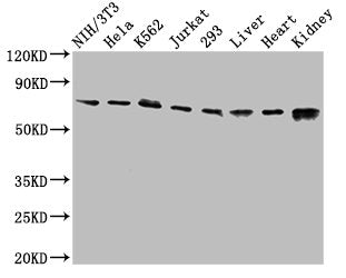 Western Blot
Positive WB detected in: NIH/3T3 whole cell lysate, Hela whole cell lysate, K562 whole cell lysate, Jurkat whole cell lysate, 293 whole cell lysate, Rat liver tissue, Mouse heart tissue, Mouse kidney tissue
All lanes: RIPK1 antibody at 3.2µg/ml
Secondary
Goat polyclonal to rabbit IgG at 1/50000 dilution
Predicted band size: 76, 71 kDa
Observed band size: 76 kDa
