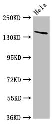 Western Blot
Positive WB detected in: Hela whole cell lysate
All lanes: LAMC2 antibody at 5ug/ml
Secondary
Goat polyclonal to rabbit IgG at 1/50000 dilution
Predicted band size: 131, 122 kDa
Observed band size: 140 kDa