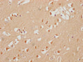 IHC image of CSB-PA618895LA01HU diluted at 1:200 and staining in paraffin-embedded human brain tissue performed on a Leica BondTM system. After dewaxing and hydration, antigen retrieval was mediated by high pressure in a citrate buffer (pH 6.0). Section was blocked with 10% normal goat serum 30min at RT. Then primary antibody (1% BSA) was incubated at 4°C overnight. The primary is detected by a Goat anti-rabbit polymer IgG labeled by HRP and visualized using 0.05% DAB.
